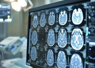 Telemedicina, progetto telestroke permette di trattare ictus a distanza Telemedicina, progetto telestroke permette di trattare ictus a distanza