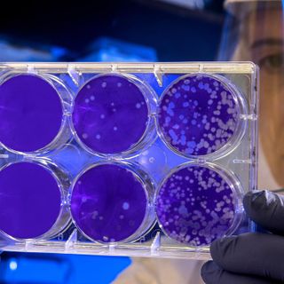 Coronavirus in Piemonte: oggi cinque decessi, altri 157 guariti