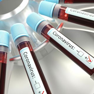 Coronavirus, nessun nuovo decesso in Piemonte. Altri 26 pazienti guariti