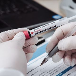 Coronavirus, altri 32 morti in Piemonte. Ma il totale dei guariti sfiora quota 10 mila