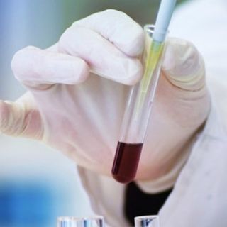 vaccino tumore pancreas e prof. novelli