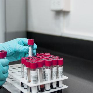 Test sierologici: una gestione unica delle analisi, sia nel pubblico che nel privato