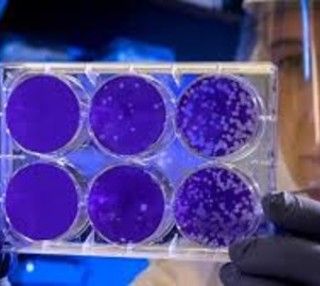 Coronavirus, altre 29 vittime: è la giornata più &quot;nera&quot; per il Piemonte. E Mattarella telefona a Cirio
