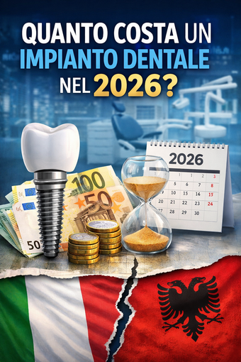 Impianti dentali nel 2026: quanto spendono davvero i piemontesi e quali alternative esistono