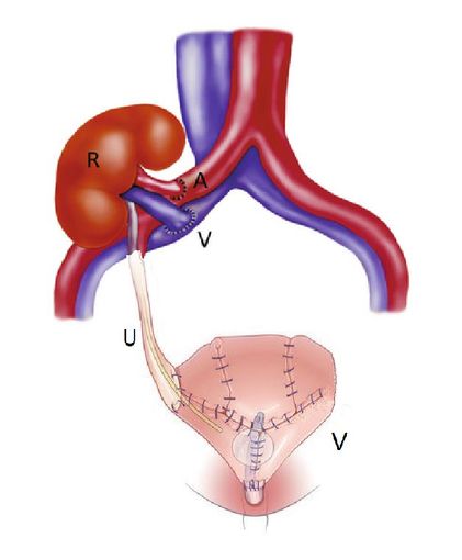 Alle Molinette, un intervento senza precedenti salva la vita a un 29enne Alle Molinette, un intervento senza precedenti salva la vita a un 29enne