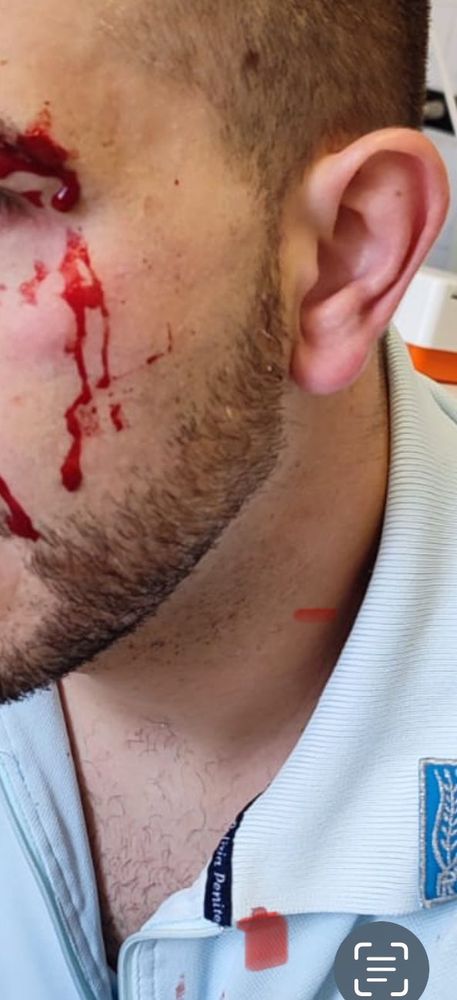 Carcere di Ivrea, detenuto aggredisce un poliziotto e gli spacca un sopracciglio. Osapp: "Si dichiari lo stato di emergenza" Carcere di Ivrea, detenuto aggredisce un poliziotto e gli spacca un sopracciglio. Osapp: "Si dichiari lo stato di emergenza"