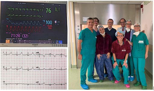 Gli “angeli” del Regina Margherita salvano una bimba di due anni: intervento mininvasivo al cuore Gli “angeli” del Regina Margherita salvano una bimba di due anni: intervento mininvasivo al cuore