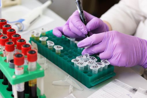 Coronavirus, Marnati: &quot;Piemonte da record per tracciamento con test virologico rispetto a Lombardia, Veneto ed Emilia Romagna&quot;