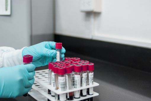 Test sierologici: una gestione unica delle analisi, sia nel pubblico che nel privato Test sierologici: una gestione unica delle analisi, sia nel pubblico che nel privato