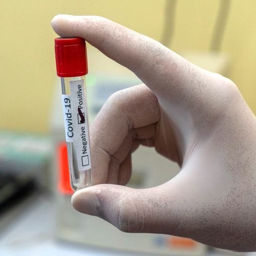 Educatrice positiva al Covid alla Mazzucchelli di Chivasso. Bambini in quarantena fino al1 agosto
