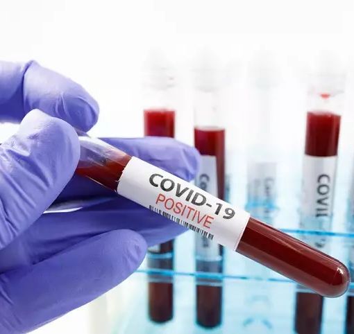 coronavirus - foto d'archivio