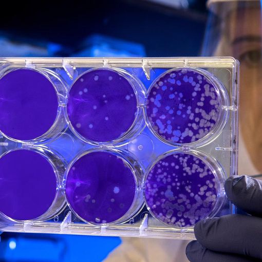 Coronavirus in Piemonte: oggi cinque decessi, altri 157 guariti