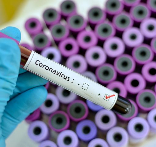 Coronavirus, ancora 12 decessi in Piemonte (nessuno nella giornata odierna), solo 24 i nuovi casi positivi