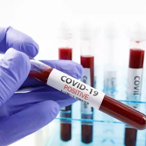 Covid, in Piemonte 3.249 nuovi positivi: salgono i ricoveri in ospedale