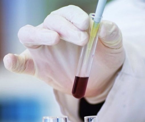 vaccino tumore pancreas e prof. novelli