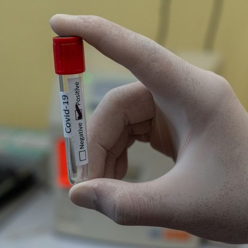 Coronavirus, opposizioni all'attacco in Regione: &quot;Tamponi al palo, dobbiamo riaprire l'unità di crisi. Il Piemonte mostra tutta la sua fragilità&quot;