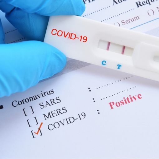 Test rapido Coronavirus