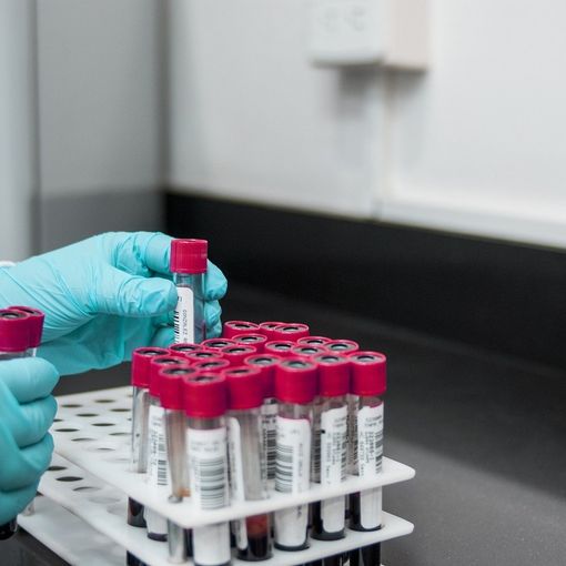 Test sierologici: una gestione unica delle analisi, sia nel pubblico che nel privato