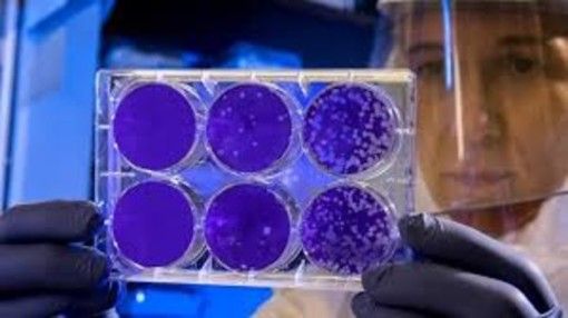 Coronavirus, altre 29 vittime: è la giornata più &quot;nera&quot; per il Piemonte. E Mattarella telefona a Cirio
