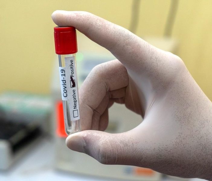 Educatrice positiva al Covid alla Mazzucchelli di Chivasso. Bambini in quarantena fino al1 agosto