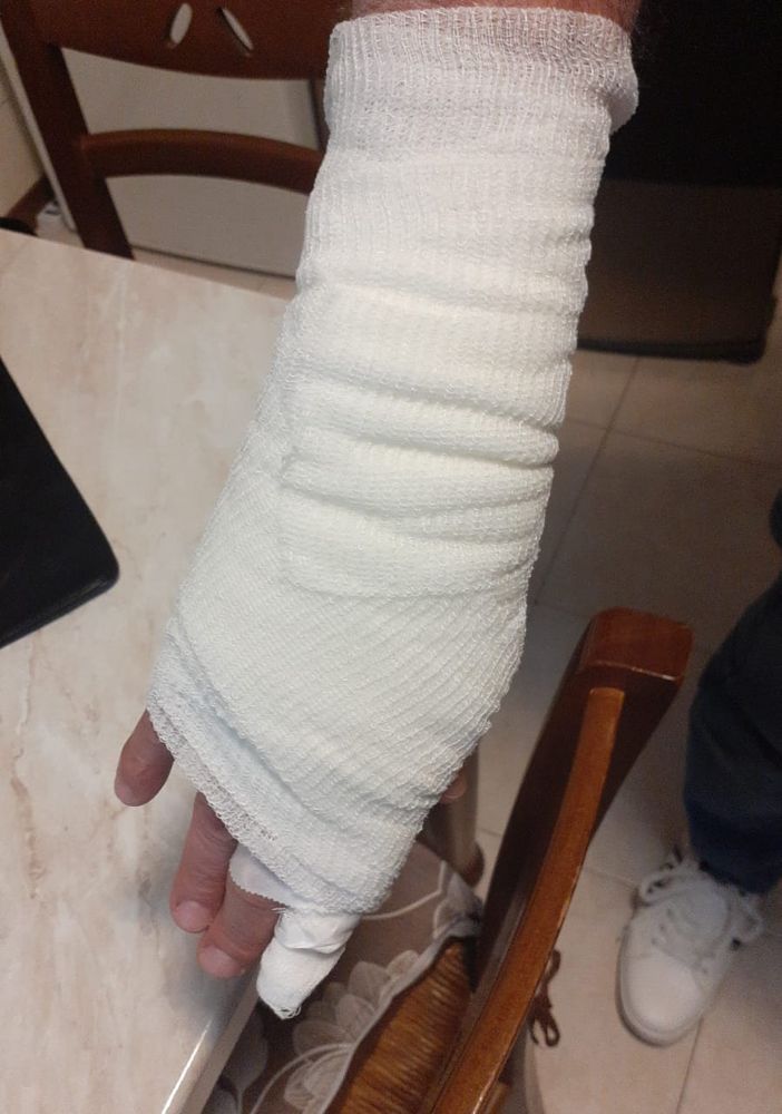 Detenuto straniero ricoverato all'ospedale di Ciriè va fuori di testa e picchia due agenti