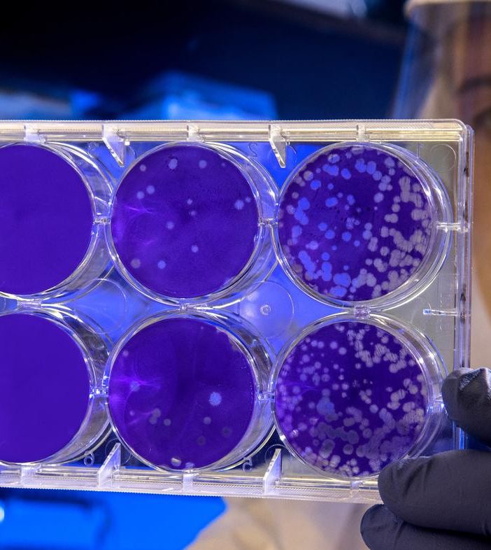 Coronavirus in Piemonte: oggi cinque decessi, altri 157 guariti