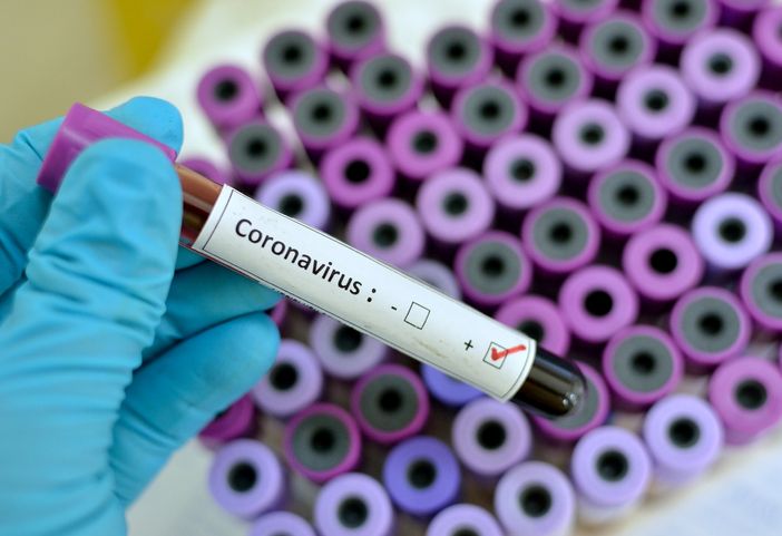 Coronavirus: tredici nuovi decessi in Piemonte, tre in provincia di Torino