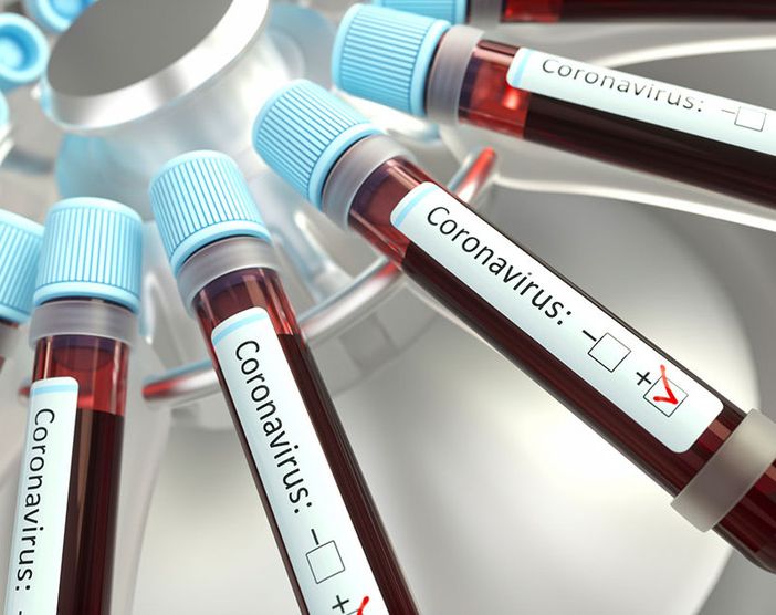 Coronavirus, nessun nuovo decesso in Piemonte. Altri 26 pazienti guariti