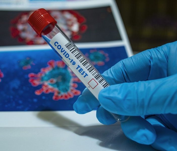 Covid Piemonte: nelle ultime 24 ore altri 11 mila casi positivi e un decesso