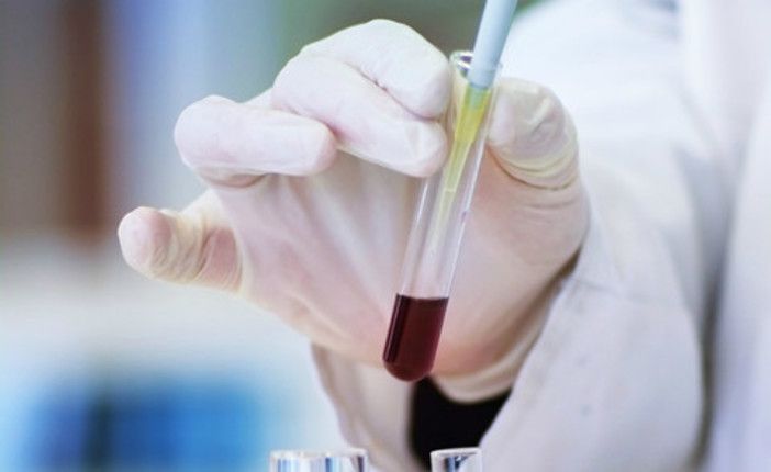 vaccino tumore pancreas e prof. novelli