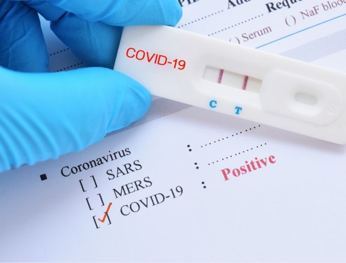 Test rapido Coronavirus