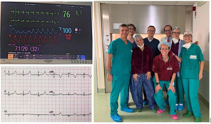 Gli “angeli” del Regina Margherita salvano una bimba di due anni: intervento mininvasivo al cuore