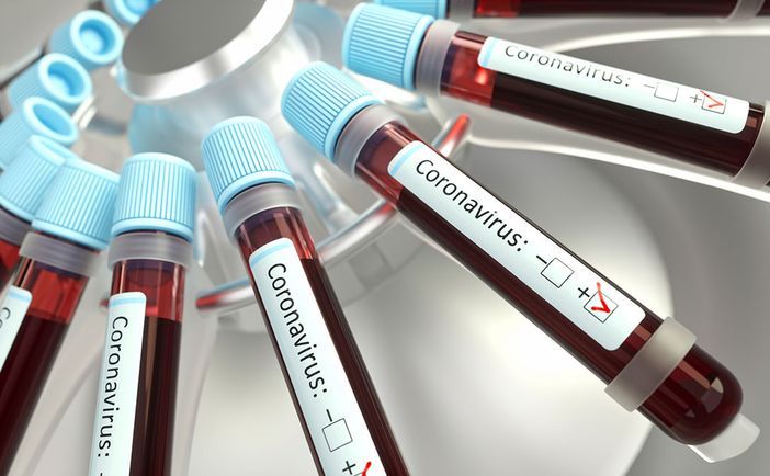Ancora 54 morti per il coronavirus in Piemonte, ma calano di oltre 100 unità i ricoveri tra terapie intensive e ospedali Ancora 54 morti per il coronavirus in Piemonte, ma calano di oltre 100 unità i ricoveri tra terapie intensive e ospedali