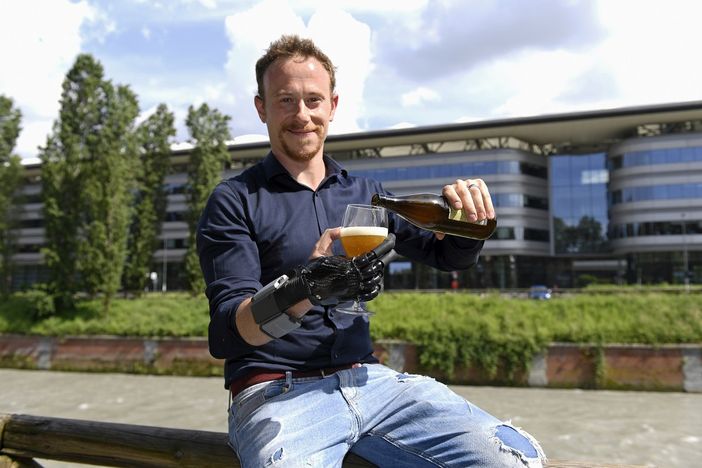 Marco Bucci con la sua mano bionica