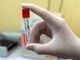 Coronavirus, in Piemonte 66 nuovi contagiati e 12 guariti