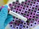 Coronavirus: tredici nuovi decessi in Piemonte, tre in provincia di Torino