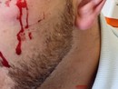 Carcere di Ivrea, detenuto aggredisce un poliziotto e gli spacca un sopracciglio. Osapp: &quot;Si dichiari lo stato di emergenza&quot;
