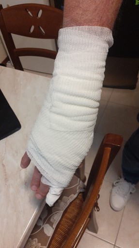 Detenuto straniero ricoverato all'ospedale di Ciriè va fuori di testa e picchia due agenti