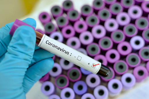 coronavirus - foto d'archivio