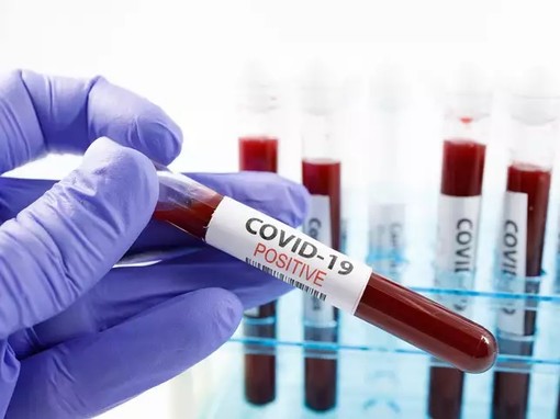 coronavirus - foto d'archivio
