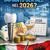 Impianti dentali nel 2026: quanto spendono davvero i piemontesi e quali alternative esistono