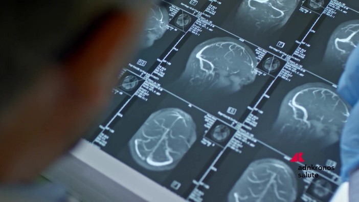 Fenilchetonuria, 'screening neonatale evita danni neurologici ma serve continuità assistenziale' Fenilchetonuria, 'screening neonatale evita danni neurologici ma serve continuità assistenziale'