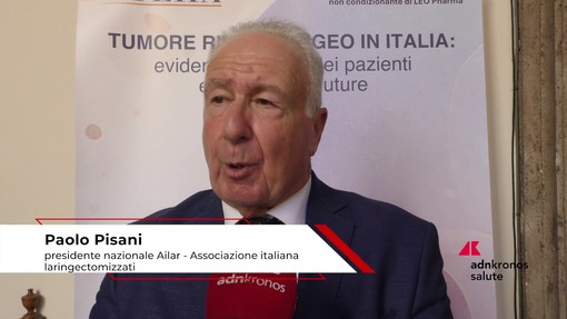 Tumore rinofaringeo, Pisani (Ailar): "Paziente ha diritto a cure multidisciplinari" Tumore rinofaringeo, Pisani (Ailar): "Paziente ha diritto a cure multidisciplinari"