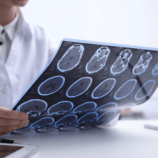 Sclerosi multipla, neurologi: &quot;Con nuovi strumenti la diagnosi sempre più precoce&quot;