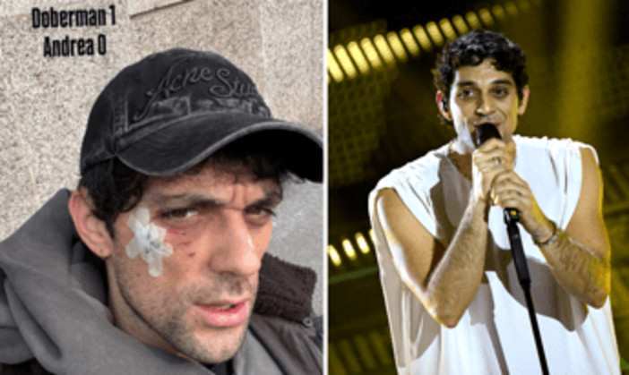 Bresh ferito al volto da un Dobermann, come sta il cantante Bresh ferito al volto da un Dobermann, come sta il cantante