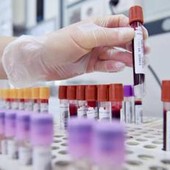 Hiv, dalla Sicilia il modello per estendere terapie long acting Hiv, dalla Sicilia il modello per estendere terapie long acting