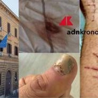 &quot;Picchiato e sequestrato per due giorni da altri detenuti a Regina Coeli&quot;, la denuncia choc