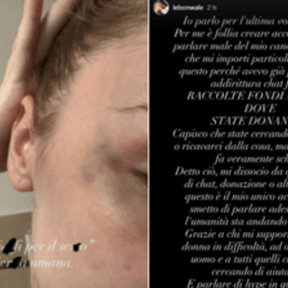 Rapper Faneto sotto accusa, l'ex fidanzata pubblica foto e messaggi di violenza