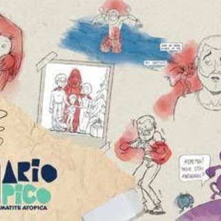 Dermatite atopica, oltre 1,3 mln di persone hanno visto il corto 'Diario atipico'