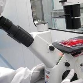Tumori, in 5 anni di Car-T curati 1.800 italiani: &quot;Il viaggio continua destinazione futuro&quot;